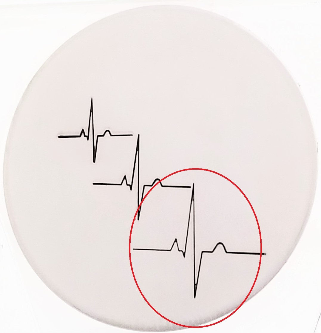 Heartbeat