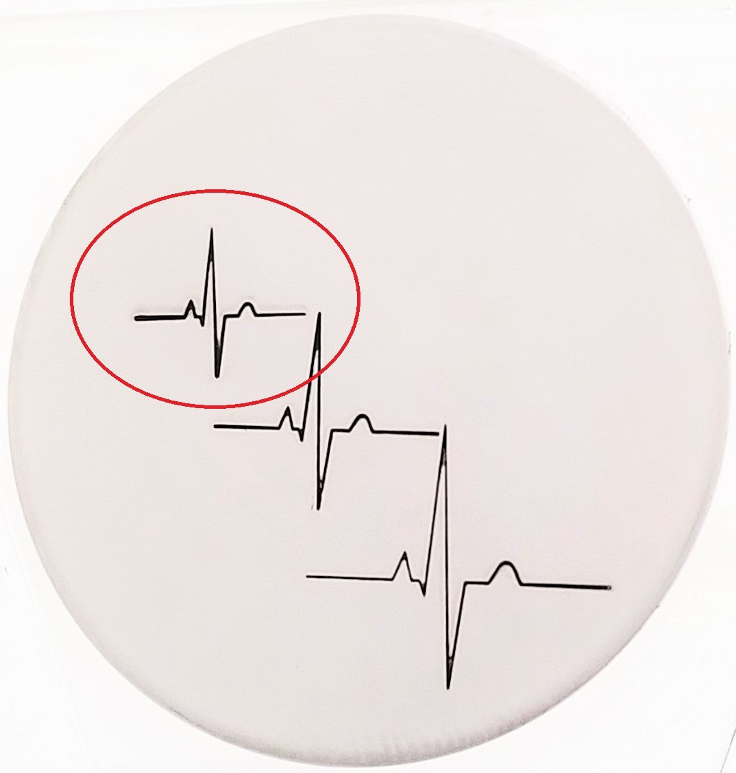 Heartbeat
