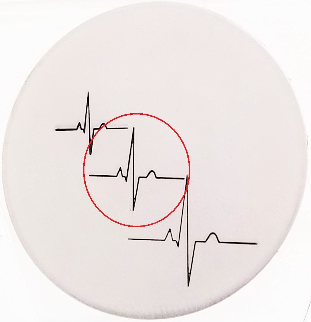 Heartbeat