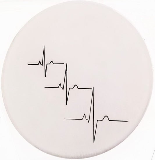 Heartbeat